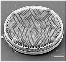 Diatomea bajo el microscopio de barrido Diatomea bajo el microscopio de barrido