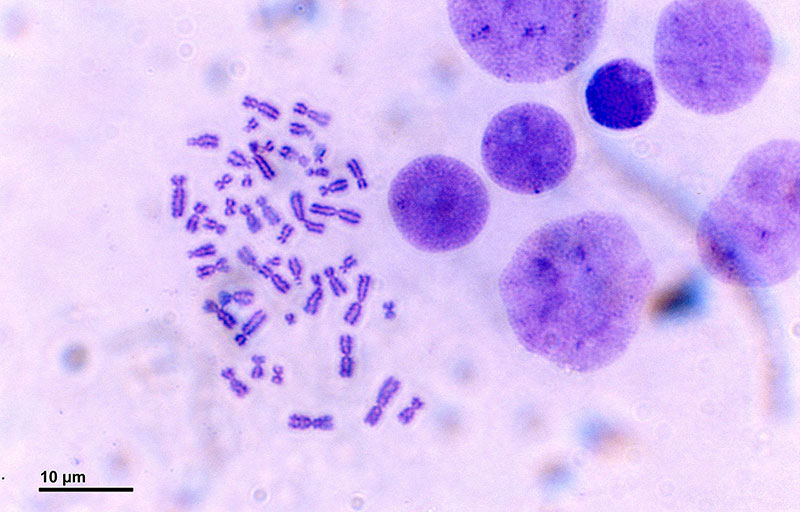 Cromosomas de una célula humana