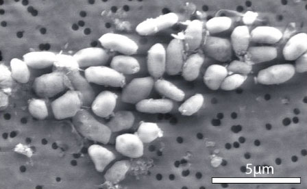 Imagen de microscopio electrónico de barrido de la GFAJ-1 - Science / AAAS